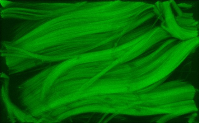With a three-year grant from the National Science Foundation, Spencer Lake’s lab plans to apply a method used in geography for describing geospatial images to "map out" the location-specific properties of tendons and unveil which features best predict how tendons function in the body. Results of their research could potentially help to prevent common tendon injuries as well as inform new treatment strategies. (Credit: Lake lab)